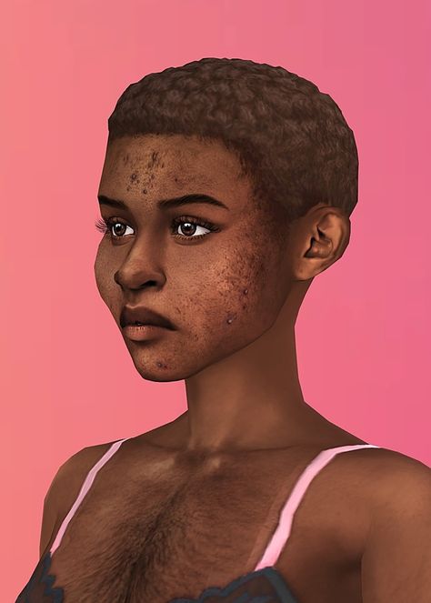 PCOS THINGS REMAKE | Patreon Ts4 Acne, Sims 4 Cc Acne Patreon, Acne Sims 4, Acne Sims 4 Cc, Sims 4 Acne Cc, Sims 4 Cas, Ts4 Cc, Cc Finds, Sims Mods