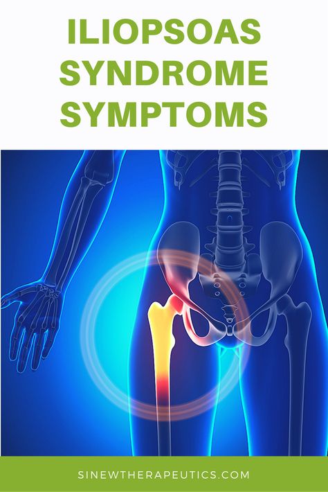 Iliopsoas Bursitis, Psoas Muscle Pain, Hip Flexor Exercises, Hip Pain Relief, Hip Problems, Sciatica Pain Relief, Psoas Muscle, Nerve Pain Relief, Sciatica Pain