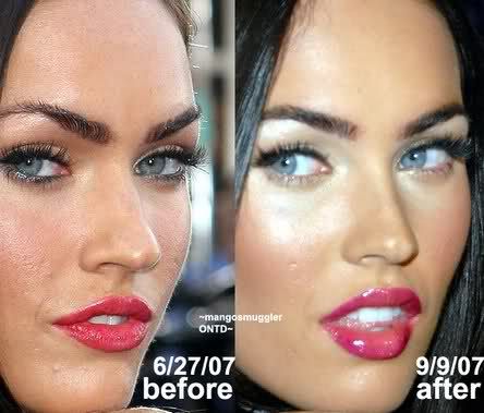 Megan Fox Nose, Fox Nose, Meghan Fox, Facelift Without Surgery, Filler Lip, Botox Before And After, Hair Implants, Lipstick For Fair Skin, Celebrity Plastic Surgery