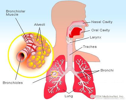 emedicinehealth/ Pulmonary Edema Essential Oil For Bronchitis, Essential Oils For Asthma, Home Remedies For Bronchitis, Natural Asthma Remedies, Sistem Pencernaan, Asthma Remedies, Asthma Relief, Upper Respiratory Infection, Asthma Symptoms