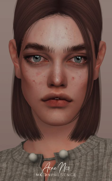 Sims 4 Cc Skin Imperfections, Pimples Sims 4 Cc, Sims 4 Skin Details Acne, Sims 4 Cc Acne Patreon, Sims 4 Cc Skin Acne, Sims 4 Cc Pimple Patches, Sims 4 Pimples Cc, Acne Cc Sims 4, Sims 4 Face Cc Presets