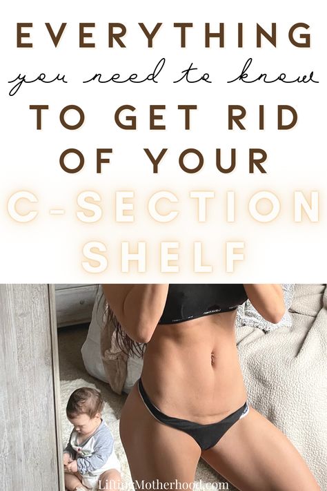 Get Rid Of C Section Pouch, Workout For C Section Pouch, Lose Baby Weight After C Section, C Section Overhang Belly, Recovery After C Section, C Section Pooch, C Section Shelf, Belly After C Section, C Section Recovery Essentials