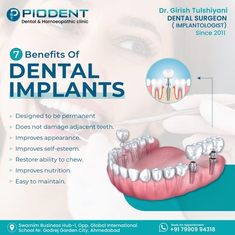 #dentalimplants #dentist #dentistry #dental #smile #teeth #cosmeticdentistry #dentalcare #dentalclinic #veneers #teethwhitening #dentalhygienist #implants #oralsurgery #oralhealth #orthodontics #dentista #smilemakeover #dentalphotography #dentalhygiene #invisalign #tooth #dentalassistant #dentistryworld #dentalstudent #smiledesign #implant #dentallab #implantdentistry Dental Care Creative Ads, Dental Implants Creative Ads, Dental Smile, Dental Posts, Dental Photography, Dental Surgeon, Improve Nutrition, Implant Dentistry, Teeth Implants