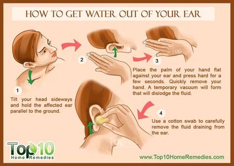 How to Get Water Out of Your Ear Water In Ear Remedy, Water In Ear, Swimmers Ear Remedy, Fluid In Ears, Valsalva Maneuver, Swimmers Ear, Vicks Vaporub Uses, Top 10 Home Remedies, Uses For Vicks