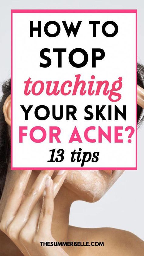 Clear Skin Overnight, Back Acne Remedies, Cystic Acne Remedies, Face Mapping Acne, Skincare Guide, Bad Acne, Pimples Remedies, Acne Free Skin, Prevent Pimples