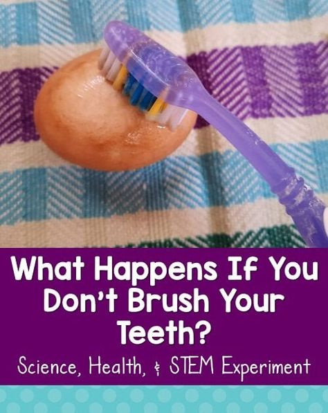 Easy science - STEM experiment shows children what happens if they don't brush their teeth. Materials: hardboiled eggs, toothbrush, soda, toothbrush. Dental Science Experiments Kids, Toothbrushing Activities, Kids Dental Health, Egg Experiments, Health Ads, Stem Experiments, Dental Health Month, Heal Cavities, Science Stem