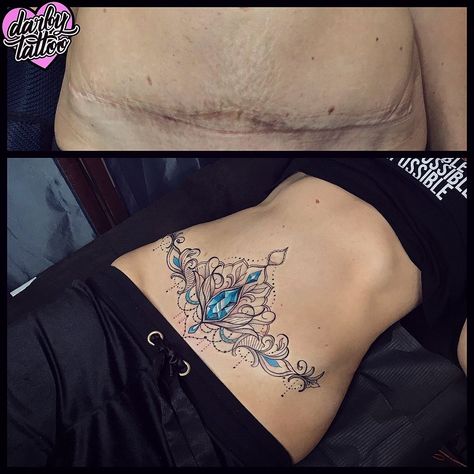 Stomach Scar Tattoo Cover Up For Women, Tummy Tucks Tattoo Cover Up, Belly Button Tattoos For Women, Belly Button Tattoos, Cover Tattoos, Lower Stomach Tattoos, Beauty Room Salon, Tattoos To Cover Scars, Belly Tattoos