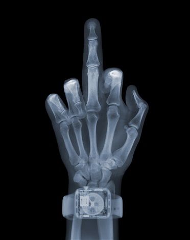 Nick Veasey's X-ray Art: See Things as They Really Are - Arte & Lusso Vincent Black Shadow, Xray Art, X-ray Images, Photography Artists, X Rays, Abstract Photography, Contemporary Art Gallery, Contemporary Artwork, British Artist