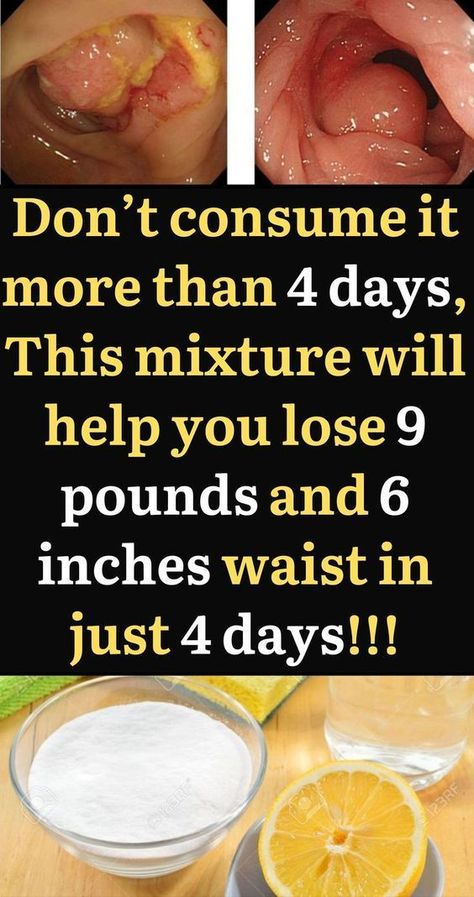 weight loss tips for women, easy diet to follow, easy diet to lose weight, easy diet for weight loss #weightloss #diet #loseweight #howtoloseweight Healthy Workout, Workout Diet, Stubborn Fat, Losing 10 Pounds, Gym Fit, Fat Fast, 10 Pounds, Health Healthy, Lose Belly