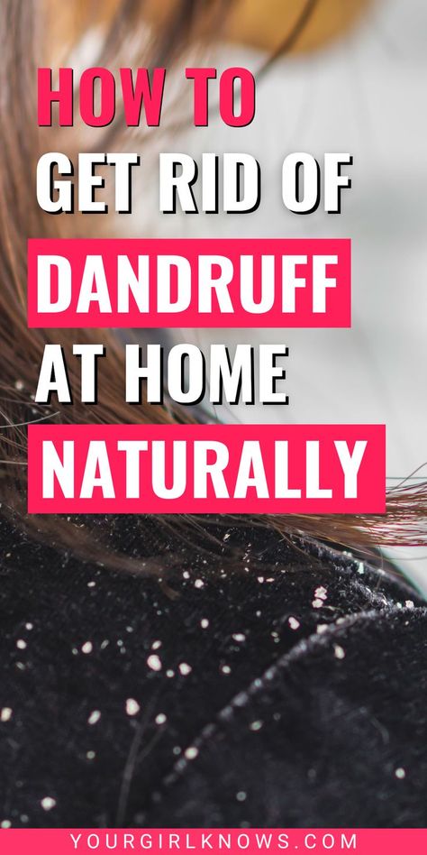 How to get rid of dandruff naturally at home : Looking for quick ways to get rid of dandruff and get a clear scalp at home? These natural remedies for dandruff are tried and tested for the problem. How To Get Rid Of Dandruff Overnight, Get Rid Of Dandruff Permanently, Natural Remedies For Dandruff, Get Rid Of Dandruff Fast, How To Remove Dandruff, Natural Dandruff Remedy, Hair Mask For Dandruff, Clear Scalp, Home Remedies For Dandruff