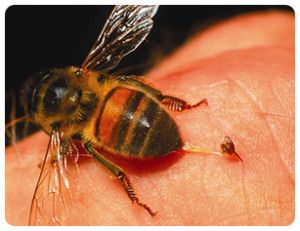 Top Natural Home Remedies for Yellow Jacket Stings Wasp Sting Remedy, Remedies For Bee Stings, Drone Bee, Jellyfish Sting, Wasp Stings, Get Rid Of Spiders, Spider Bites, Bee Venom, Bees And Wasps