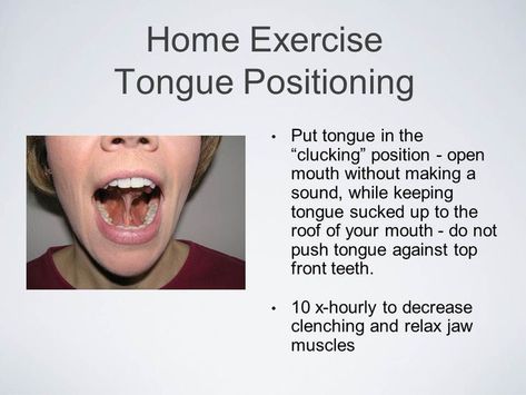 Tongue Exercises, Jaw Pain Relief, Tongue Thrust, Oral Motor Activities, Mouth Hygiene, Tmj Relief, Jaw Exercises, Jawline Exercise, Myofunctional Therapy