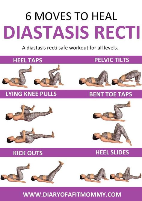 Heal and repair your Diastasis Gap at home with this workout. These exercises are gentle for the postpartum core. Recti Diastasis, Heal Diastasis Recti, After Baby Workout, Healing Diastasis Recti, Post Baby Workout, Fitness Diary, Diastasis Recti Exercises, Post Pregnancy Workout, Baby Workout