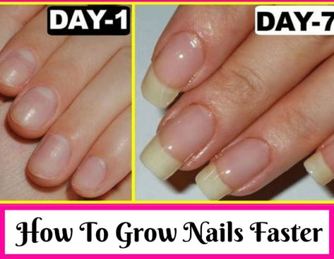 Make Nails Grow, Nail Growth Faster, Grow Long Nails, Nail Growth Tips, Grow Nails Faster, Fast Nail, Heal Cavities, Nagel Tips, How To Grow Nails