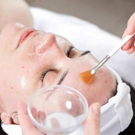 Chemical Peel Aesthetic, Peeling Face, Chemical Peeling, Face Peeling, Glycolic Acid Peel, Glycolic Peel, Massage Pictures, Peeling Facial, Acid Peel