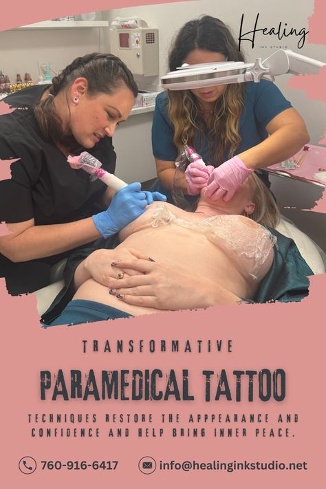 We specialize in paramedical tattoos to help individuals reclaim their confidence and enhance their natural beauty. Whether it’s for scar camouflage, areola restoration, or other medical tattooing needs, our skilled artists are dedicated to providing compassionate care and exceptional results. Join us at Healing Ink Studios, where healing and artistry come together. 💖

#HealingInkStudios
#ParamedicalTattoo
#ScarCamouflage
#AreolaRestoration
#ConfidenceRestored
#HealingThroughArt
#TattooHealing Scar Camouflage Tattoo Permanent Makeup, Paramedical Tattooing, Paramedical Tattoo, C Section Tattoo, Stretch Mark Tattoo, Tattoo Over Scar, Married Advice, Tattoo Techniques, Healing Tattoo