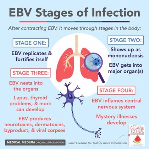 Medical Medium Blog Epstein Barr, Gut Problems, Histamine Intolerance, Anthony William, Brain Facts, Health Topics, Medical Medium, Medical Research, Functional Medicine