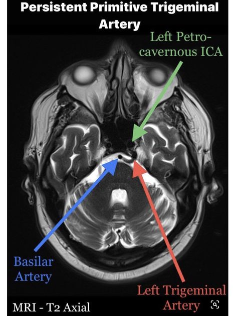 Mri Study Guide, Mri Anatomy, Mri Images, Chest Anatomy, Mri Brain, Radiology Student, Doctor Medicine, Radiology Imaging, Anatomy Bones