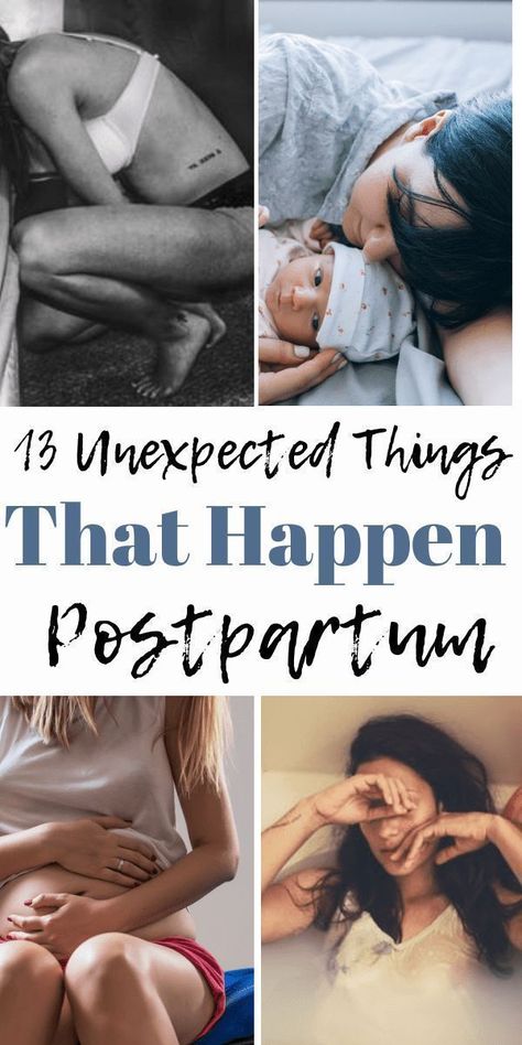 Pregnancy Hacks, Pregnancy Info, Pregnancy Information, Baby Sleep Problems, Baby Prep, Postpartum Care, Postpartum Recovery, Post Baby, After Baby