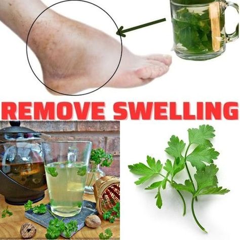 Dr Barbara O'Neill Healthy Recipes For Beginners (FANS GROUP) | If you drink this TEA, you will quickly remove the swelling of your legs, ankles and feet... | Facebook Parsley Tea, Calming Tea, Cleanse Your Liver, Natural Diuretic, Homemade Tea, Swollen Legs, Herbal Drinks, Refreshing Food, My Recipes