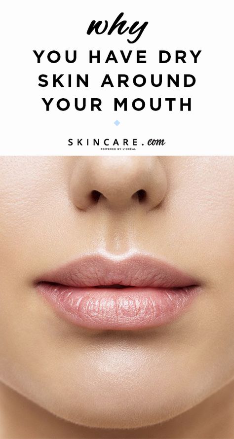 If you've ever experienced dry skin around your mouth but you don't know why, we're here to help! We tapped a board-certified dermatologist to find out exactly what causes this skin concern and what we can do to address it. Find out more, ahead! How To Get Rid Of Dark Skin Around Mouth, Get Rid Of Upper Lip Hair, How To Treat Dry Lips, Dry Skin Around Mouth, Causes Of Dry Skin, Get Rid Of Dry Skin, Combination Skin Makeup, Dry Skin Causes, Super Dry Skin