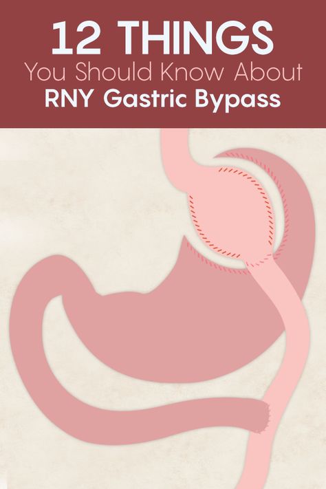 Roux N Y Surgery, Bypass Surgery Diet, Gastric Bypass Meal Plan, Liver Shrinking Diet, Gastric Bypass Sleeve, Gastric Bypass Diet, Liquid Diet Recipes, Gastric Bypass Recipes, Bariatric Sleeve