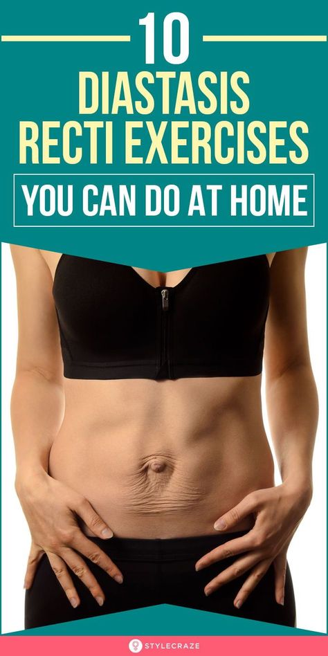 10 Diastasis Recti Exercises You Can Do At Home: To treat diastasis recti, you must exercise targeting the deep abdominal muscles and the pelvic floor muscles. Do these 10 best diastasis recti exercises at home daily to see a visible change and feel better. Read on to know about the symptoms, causes, and exercises to treat diastasis recti. #WomensHealth #Health #Fitness #HealthCare Get Rid Of Bloated Stomach, Exercises For Diastasis Recti, Monthly Goal Setting, Diastasis Recti Exercises, Progress Tracker, Ayurvedic Skin Care, Gut Health Diet, Monthly Goal, Exercises At Home