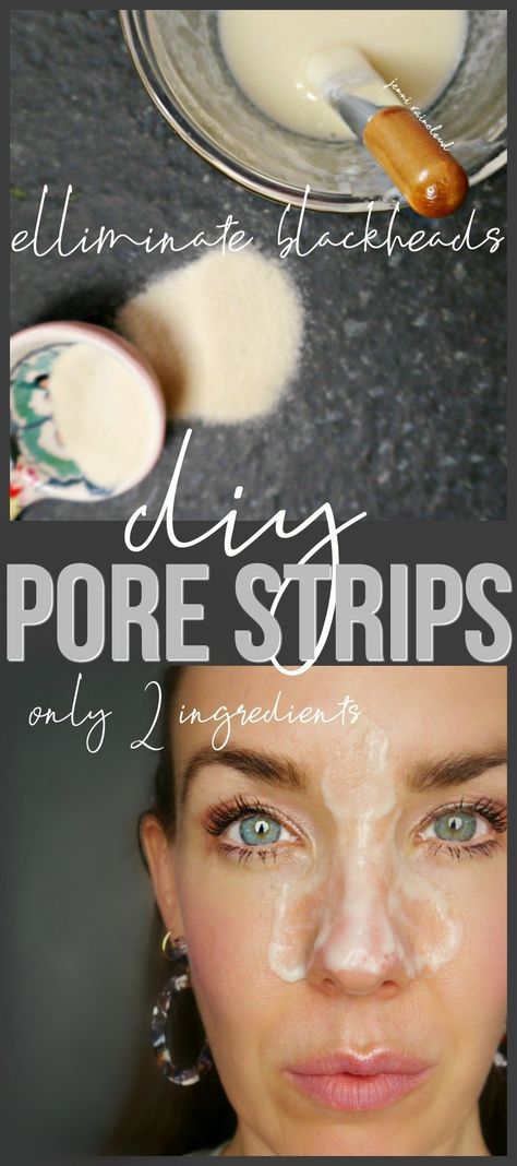 Diy Pore Strips, Homemade Pore Strips, Flat Tummy Tips, Pore Cleansing Mask, Pimples Under The Skin, Pore Strips, Pore Cleanser, How To Get Rid Of Pimples, Under Eye Wrinkles