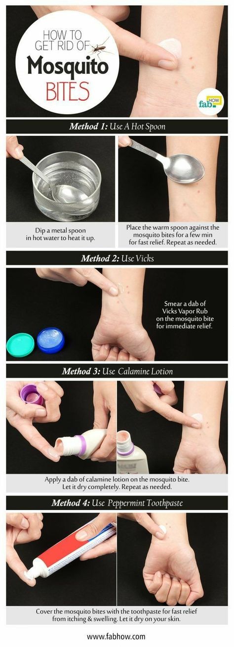 This works!! I tried the toothpaste trick just now and it stopped all the swelling, redness, and itching!!! Get Rid Of Mosquito Bites, Vicks Vapor Rub, Vicks Vapor, Calamine Lotion, Vapor Rub, Mosquito Bites, Mosquito Bite, Natural Therapy, Acne Remedies