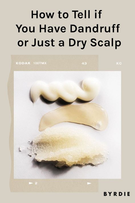 Diy For Itchy Scalp, Treating Dandruff Naturally, Diy Shampoo For Dandruff, Scalp Scrub For Dry Scalp, Diy For Dandruff Dry Scalp, Flakey Scalp How To Get Rid Of, Causes Of Dandruff, Natural Remedy For Dandruff, Best Shampoo And Conditioner For Dandruff Dry Scalp