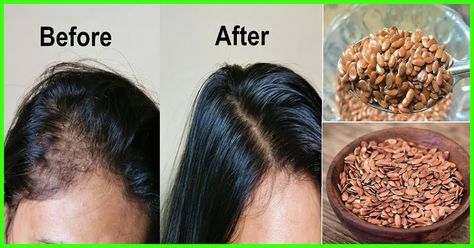 Thick Hair Remedies, Hair Growth Remedies, Flaxseed Gel, Hair Nutrition, Change Hair, Growing Hair, Hair Remedies For Growth, Boost Hair Growth, Organic Remedy