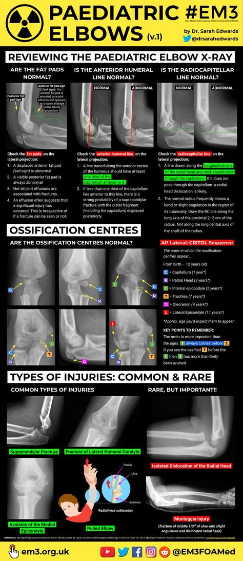 Radiography Student, Rad Tech Student, Radiology Schools, Charting For Nurses, Medical Radiography, Medical Assistant Student, Radiology Student, Radiology Technician, Radiology Imaging