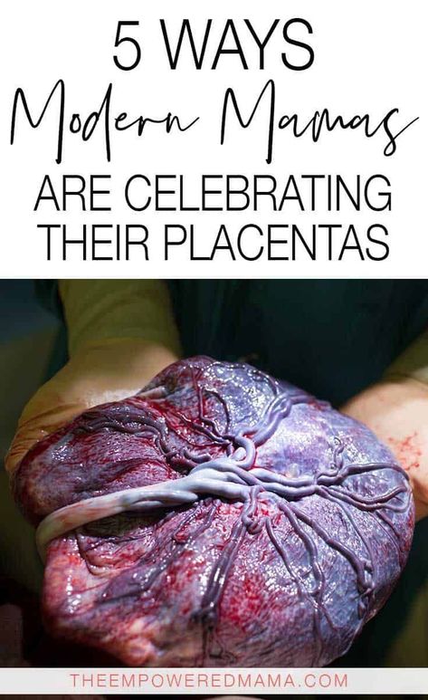 Placenta Recipes, Placenta Art, Anterior Placenta, Placenta Encapsulation, Birth Education, Modern Fonts Free, Pregnancy Help, Business Fonts, All About Pregnancy