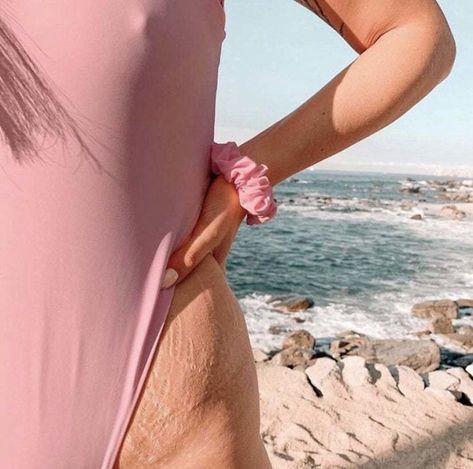 Body Positive Influencer Showing Off Her Stretch Marks Strech Marks, Body Image Issue, Stretch Mark Cream, Real Bodies, Body Acceptance, Stretch Mark, Loose Skin, Muscle Aches, Body Positive