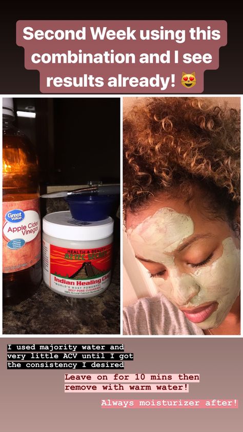 Aztec Clay Mask For Dark Spots, Indian Clay Mask Before And After, Indian Face Mask Diy, Healing Clay Mask Aztec, Native American Skin Care, Aztec Clay Mask Before And After, Indian Clay Mask, Mask Routine, Indian Healing Clay Mask