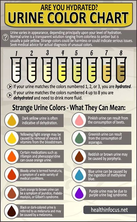 Urine Color Chart, Urine Color, Medical Student Study, Clogged Arteries, Nursing School Survival, Medical Laboratory Science, Nursing School Studying, Medical Facts, Health Professional