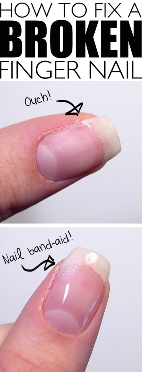 Fix Broken Nail, Repair Broken Nail, Broken Finger, Life Hacks Every Girl Should Know, Unghie Nail Art, Nail Hardener, Broken Nails, Diy Life Hacks, Cleaning Tips