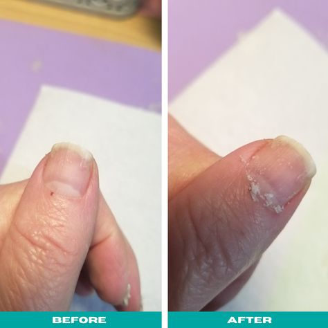 Cuticles Before And After, How To Trim Your Cuticles, Dry Cuticles How To Get Rid Of, How To Trim Cuticles At Home, How To Remove Cuticles At Home, Cuticle Remover Homemade, Bad Cuticles, Peeling Cuticles, Cuticle Repair