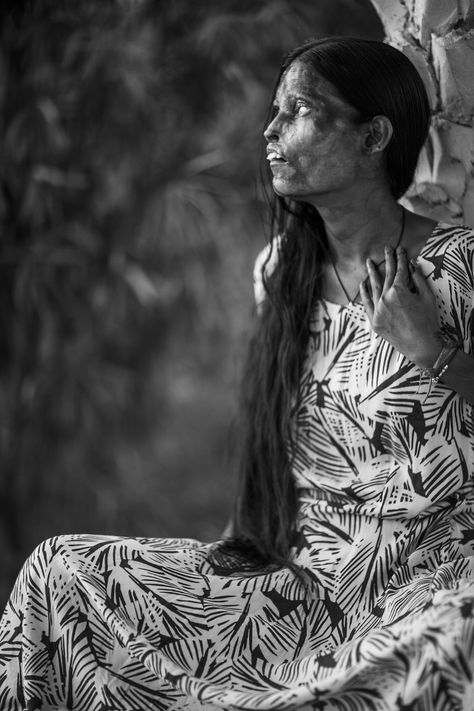 I Took Portraits Of Acid Attacks Survivors In India | Bored Panda Acid Attack, Wedding Muslim, Proposal Photos, Wedding Proposals, Human Mind, Motorcycle Design, Social Issues, Wedding Photography Poses, Romantic Weddings