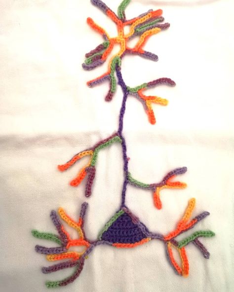 79 Likes, 11 Comments - Thepurplelilac (@thepurplelilac) on Instagram: “Normal pyramidal neuron vs #AlzheimersDisease neuron. The diseased neuron showing Tau and amyloid…” Science Crochet, Types Of Neurons, Cell Pattern, Cerebral Cortex, Step By Step Crochet, Medical Illustration, Science Education, Neuroscience, Pattern Crochet