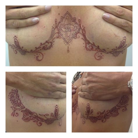 lovely tattoos that seem like henna --- nice though Scars Tattoo, Mastectomy Scars, Mastectomy Tattoo, Scar Cover Up, Tattoos To Cover Scars, Scar Tattoo, Underboob Tattoo, Breast Reconstruction, Stomach Tattoos