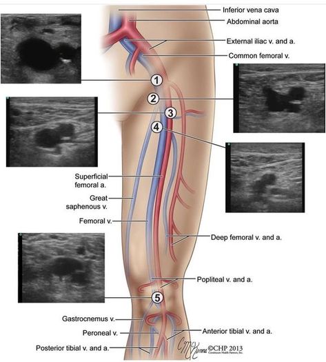 Ultrasound Anatomy, Ultrasound Notes, Ultrasound Technician Student Notes, Vascular Sonography, Ultrasound Technician Student, Sonography Humor, Sonography Aesthetic, Vascular Ultrasound Notes, Sonography Notes Ultrasound