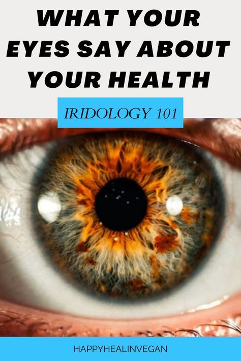 Green Eye Facts, Iridology Reading, Iridology Diagnosis, Heal Eyesight Naturally, Iridology Chart Eye, Iridology Chart, Iris Patterns Eye, Internal Health, Iris Diagnosis Eye Chart