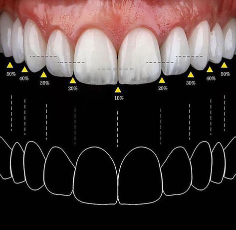 Dental Lab Technician, Dental Ceramics, Dental Pictures, Teeth Aesthetic, Dental Advertising, Dental Posters, Dental Aesthetics, Dental Videos, Veneers Teeth