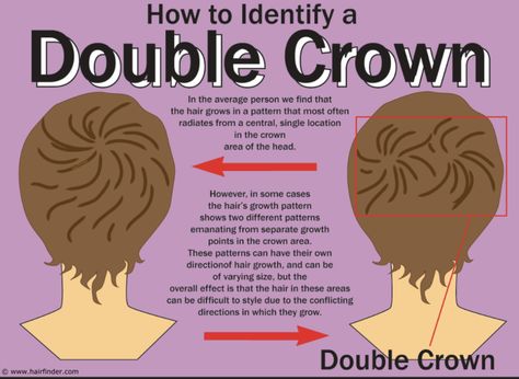 Shoulder Hair Cuts, Crown Meaning, Double Crown Hairstyles, Hair Whorl, Hair Growth Patterns, Matrix Hairstyle, List Of Hairstyles, Blonde Hair Tan Skin, Hair Tan Skin