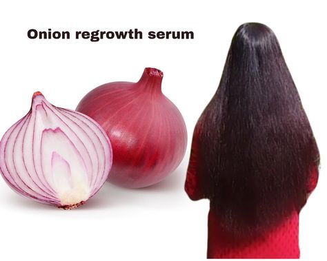 Here I'm sharing little DIY natural remedies for hair growth and smooth gel for hair Onion Juice For Hair, Remedies For Hair Growth, Gel For Hair, Castor Oil Hair, Diy Natural Remedies, Onion Juice, Hair Growth Secrets, Castor Oil For Hair, Diy Remedies