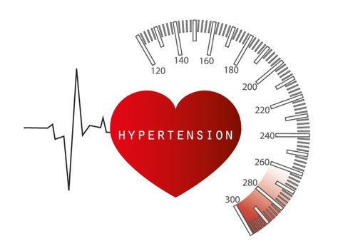 Hypertension is a chronic medical condition that affects one in three adults in the US, according to the Center for Disease Control and Prevention (CDC). Also called the silent killer, it is a condition where the blood pressure is abnormally elevated. What Is Blood Pressure, Throbbing Headache, Silent Killer, Nurse Art, Normal Blood Pressure, Healthy Lifestyle Habits, Disease Control, Blood Vessels, Medical Conditions