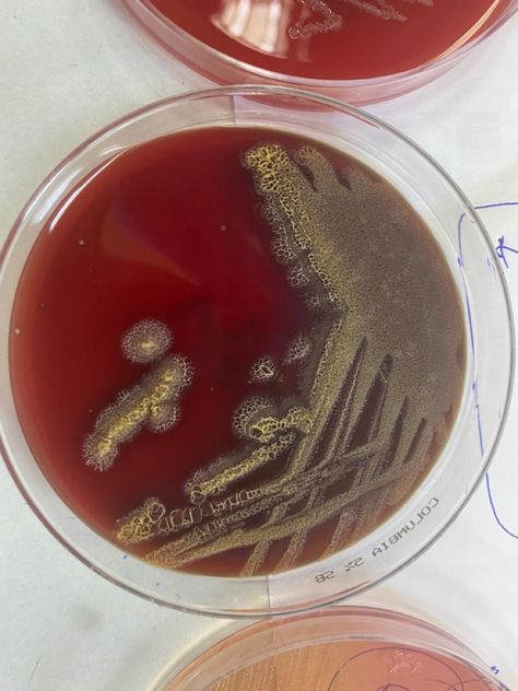 Pseudomonas aeruginosa on 5% Sheep blood agar #pseudomonas #microbiology #clinical #biology #science #genetics #bacteria #pathologic Science Genetics, Medical Laboratory Technologist, Medical Laboratory Science Student, Pseudomonas Aeruginosa, Biology Science, Medical Laboratory Science, Medical Laboratory, Laboratory Science, Science Student