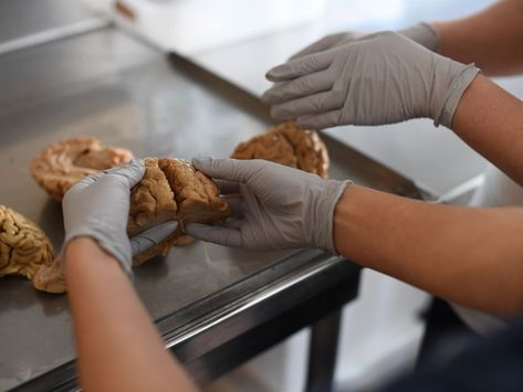 Inside a Brain Bank, Where Humans' Most Precious Organ Is Dissected and Studied | Science | Smithsonian Mclean Hospital, Lewy Body, Frontal Lobe, Organ Transplant, Brain Tissue, Organ Donation, Reduce Body Fat, Neurological Disorders, Human Brain