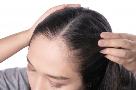 Young asian women worry about problem ha... | Premium Photo #Freepik #photo Hair Growth Serum Diy, Diy Hair Oil, Best Hair Conditioner, Hair Growth Secrets, Bald Patches, Best Hair Transplant, Hair Growth Serum, Hair Growth Faster, Normal Hair